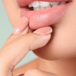 08-Lip-Fillers - Aesthetic
