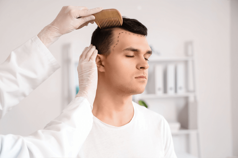 02-Men’s-Hair-Loss-Treatment