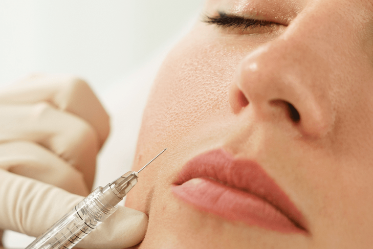 09-Dermal-Fillers